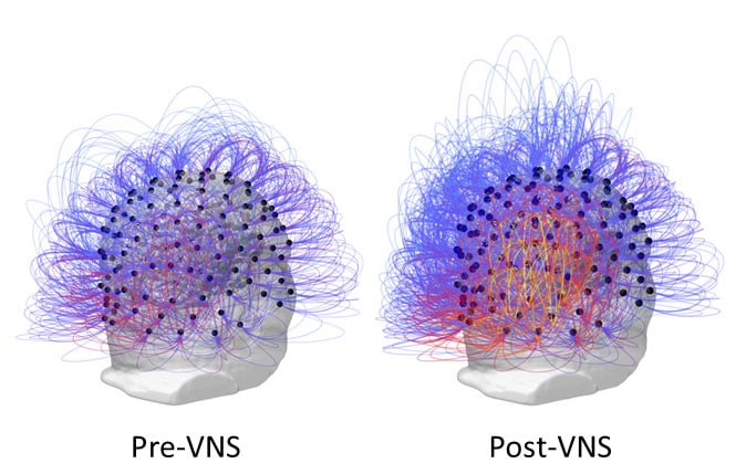 Image credit: Corazzol et al.
