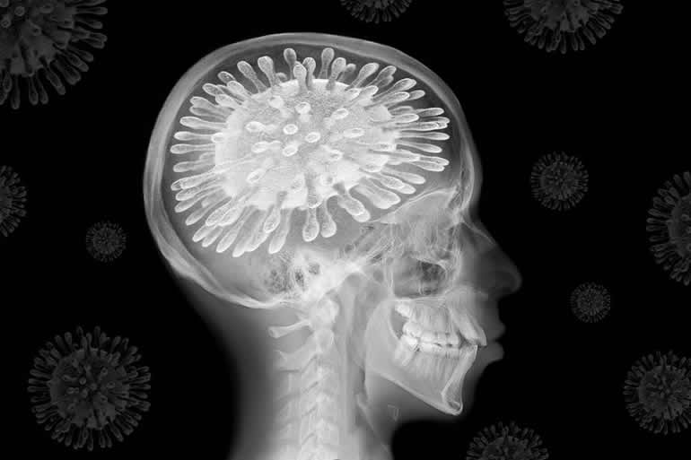 This drawing has covid 19 in the head in place of a brain